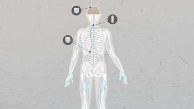 فيديو يوضح كيف تم زرع شريحة ذكاء اصطناعي في دماغ رجل مشلول وساعدته على استعادة الحركة