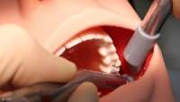 علماء بريطانيون يكتشفون ماده تعيد بناء الاسنان