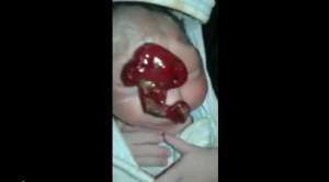 بالفيديو.. حالة نادرة لطفل حديث الولاده بالسويس واسرته تستغيث بالاطباء لتشخيص الحالة