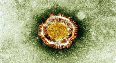 معلومات عن فيروس «نيباه» وطرق انتقاله والوقايه